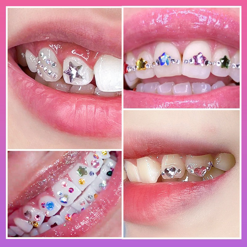 НОВЫЙ Профессиональный набор д – обзор и цена Tooth Gem Kit