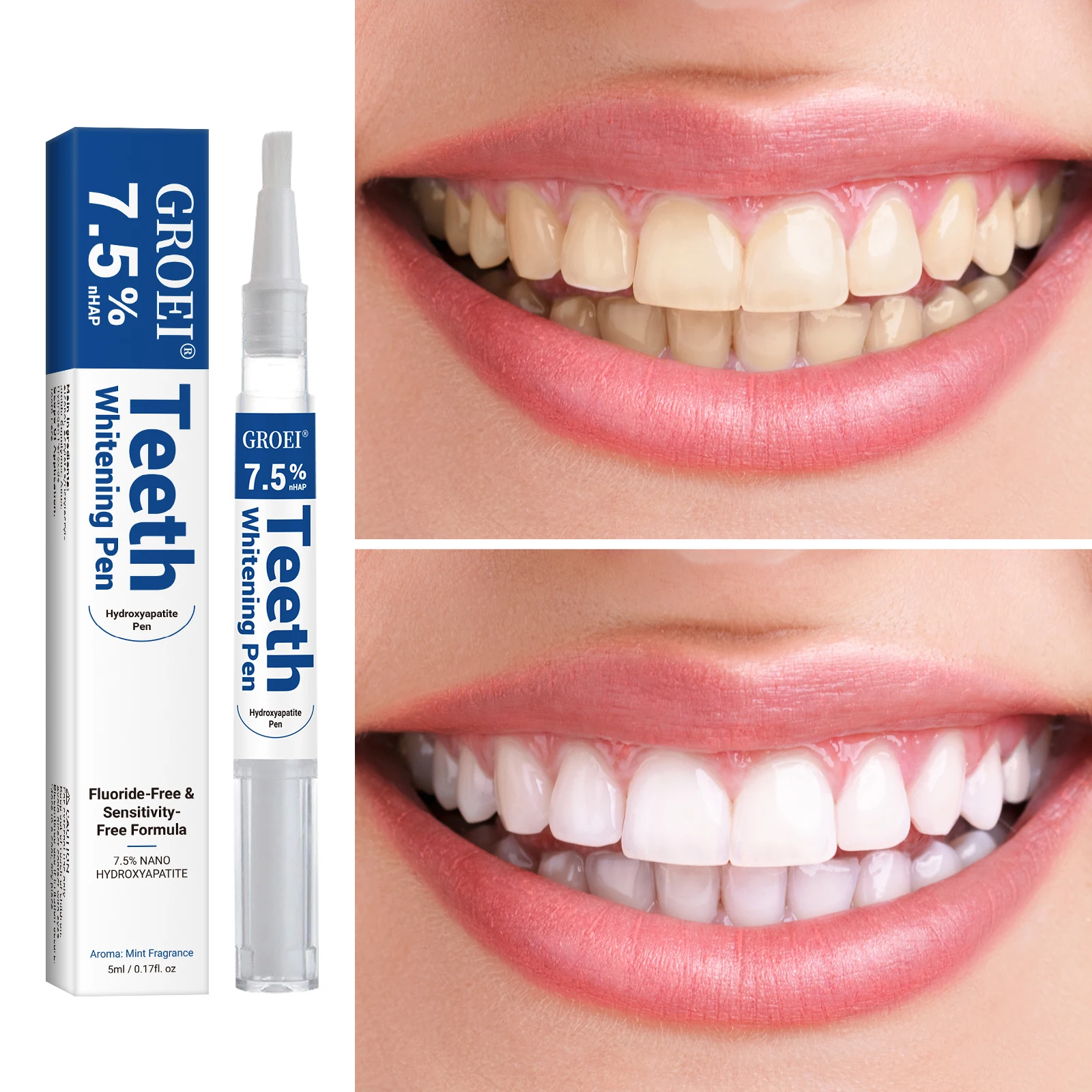 Гидроксипатитовая ручка для от – обзор и цена Teeth Whitening Gel Peroxide