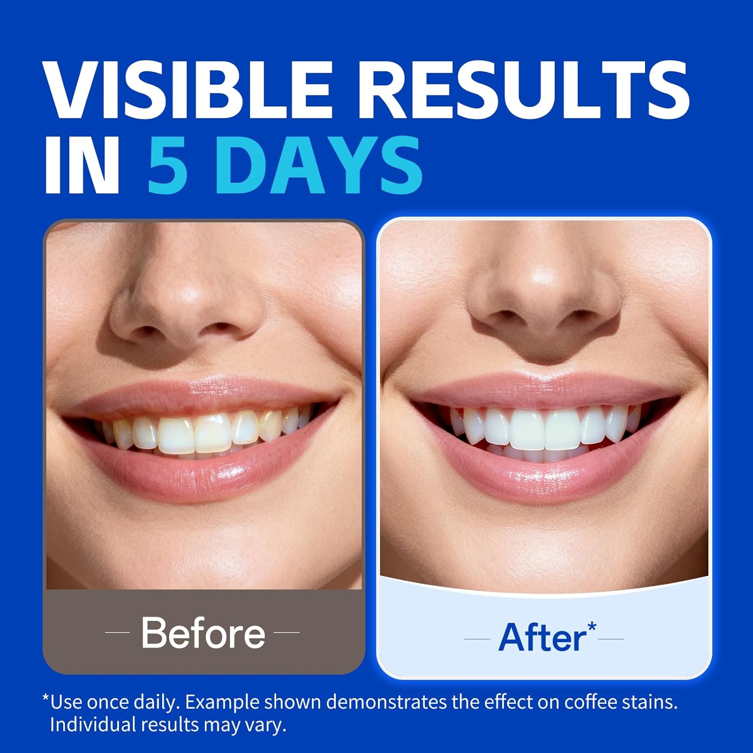 7 пар полосок для отбеливания  – обзор и цена Teeth Whitening Strips Crest