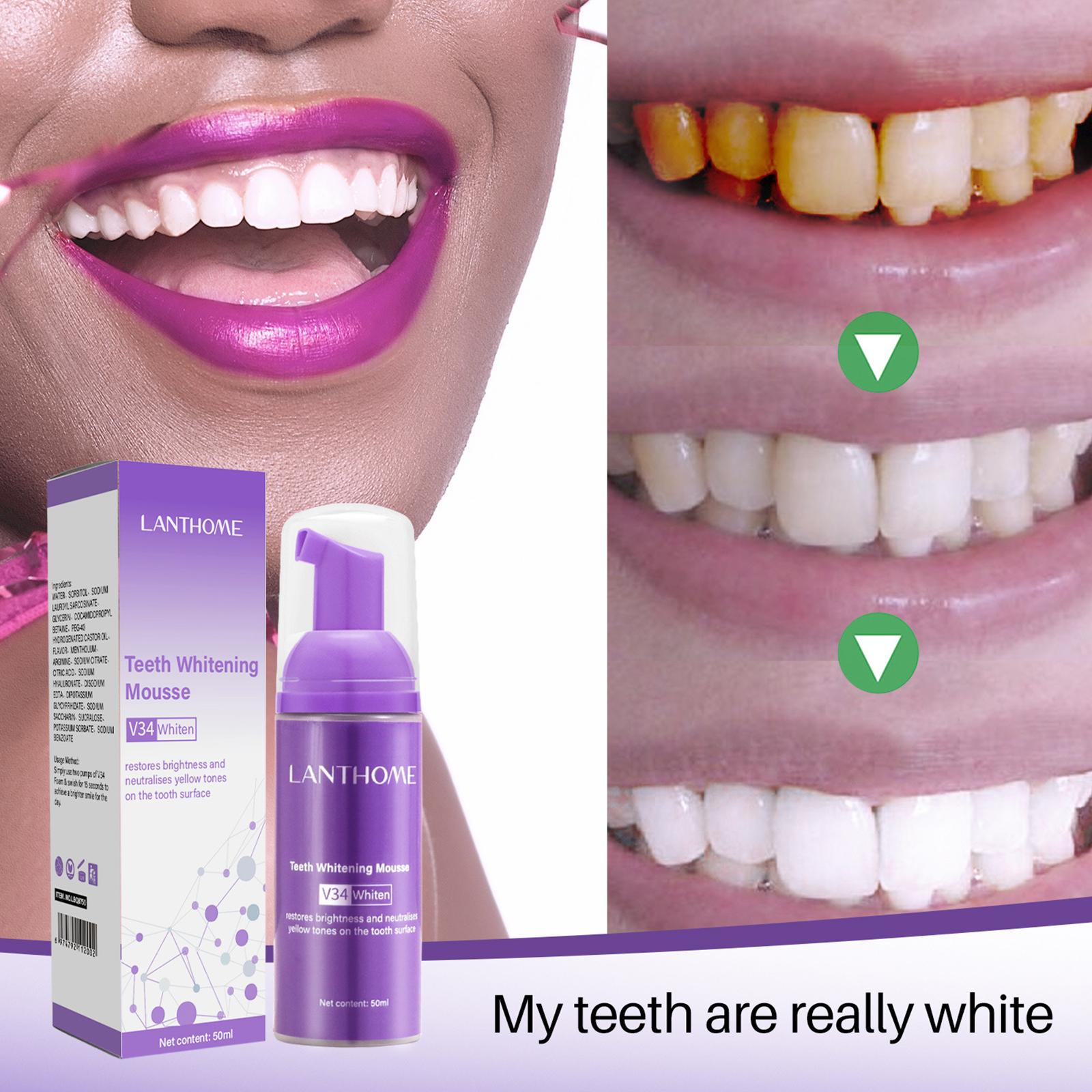 V34 Мусс для чистки зубов, зуб – обзор и цена Teeth Whitening Crest