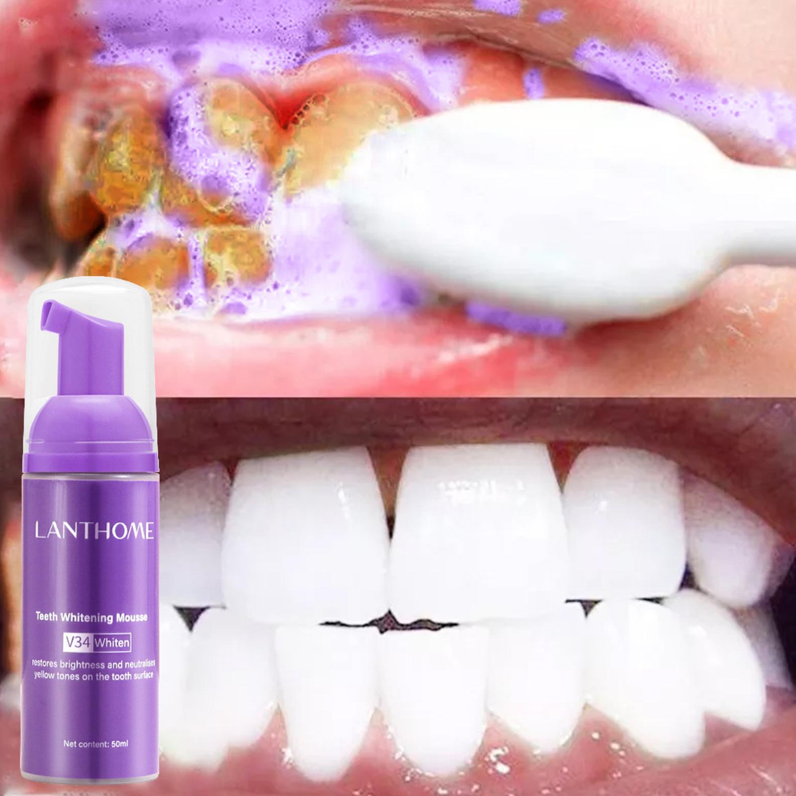 V34 Мусс для чистки зубов, зуб – обзор и цена Teeth Whitening Crest