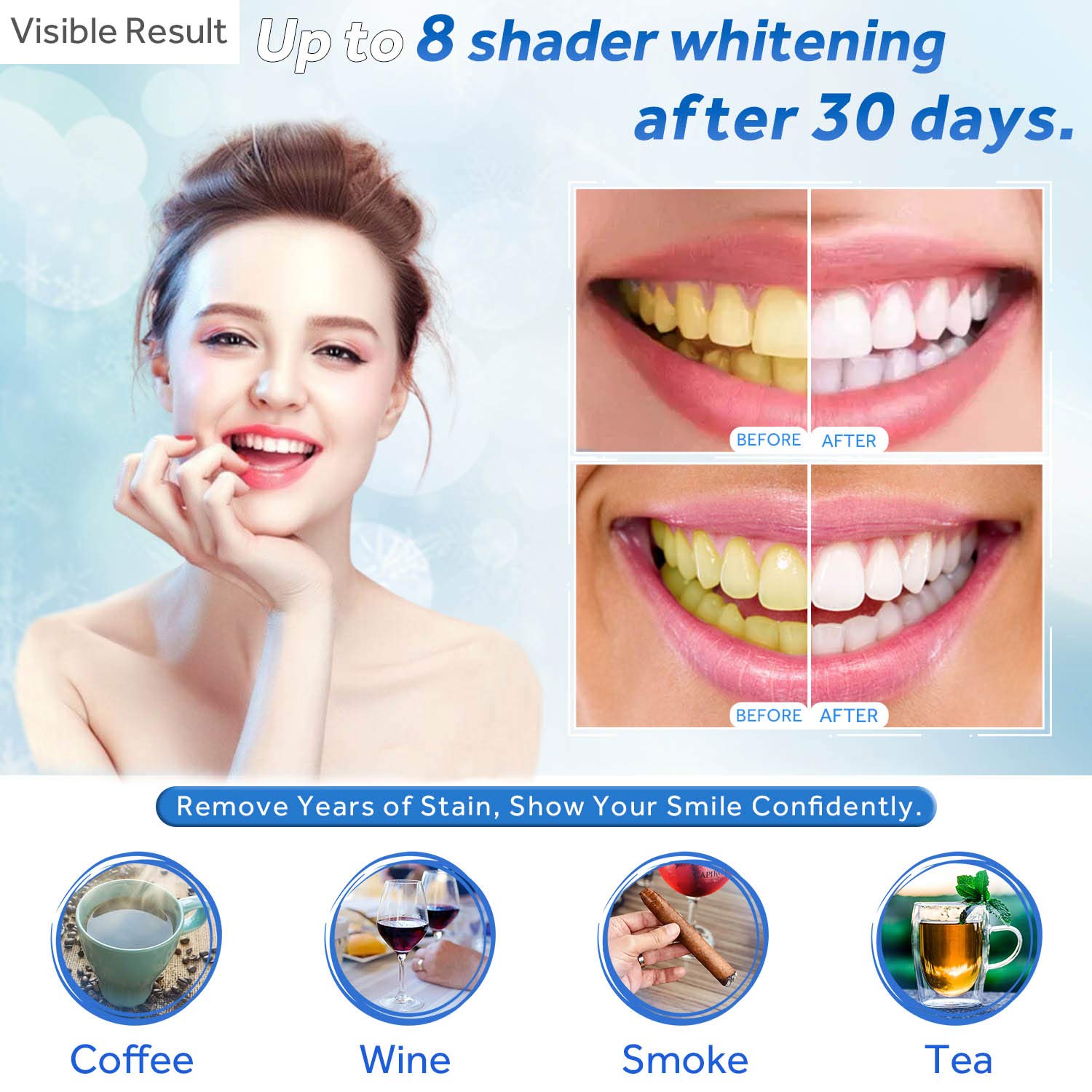 Гель для отбеливания зубов, шп – обзор и цена Teeth Whitening Gel Peroxide