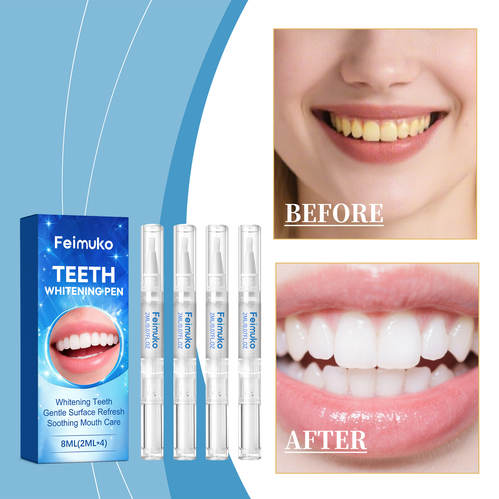 Гель-карандаш для зубов Feimuk – обзор и цена Teeth Whitening Pen