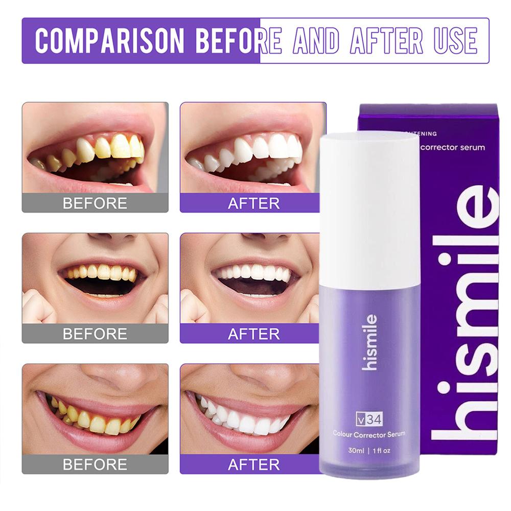    Сыворотка-корректор для от – обзор и цена Teeth Whitening Crest