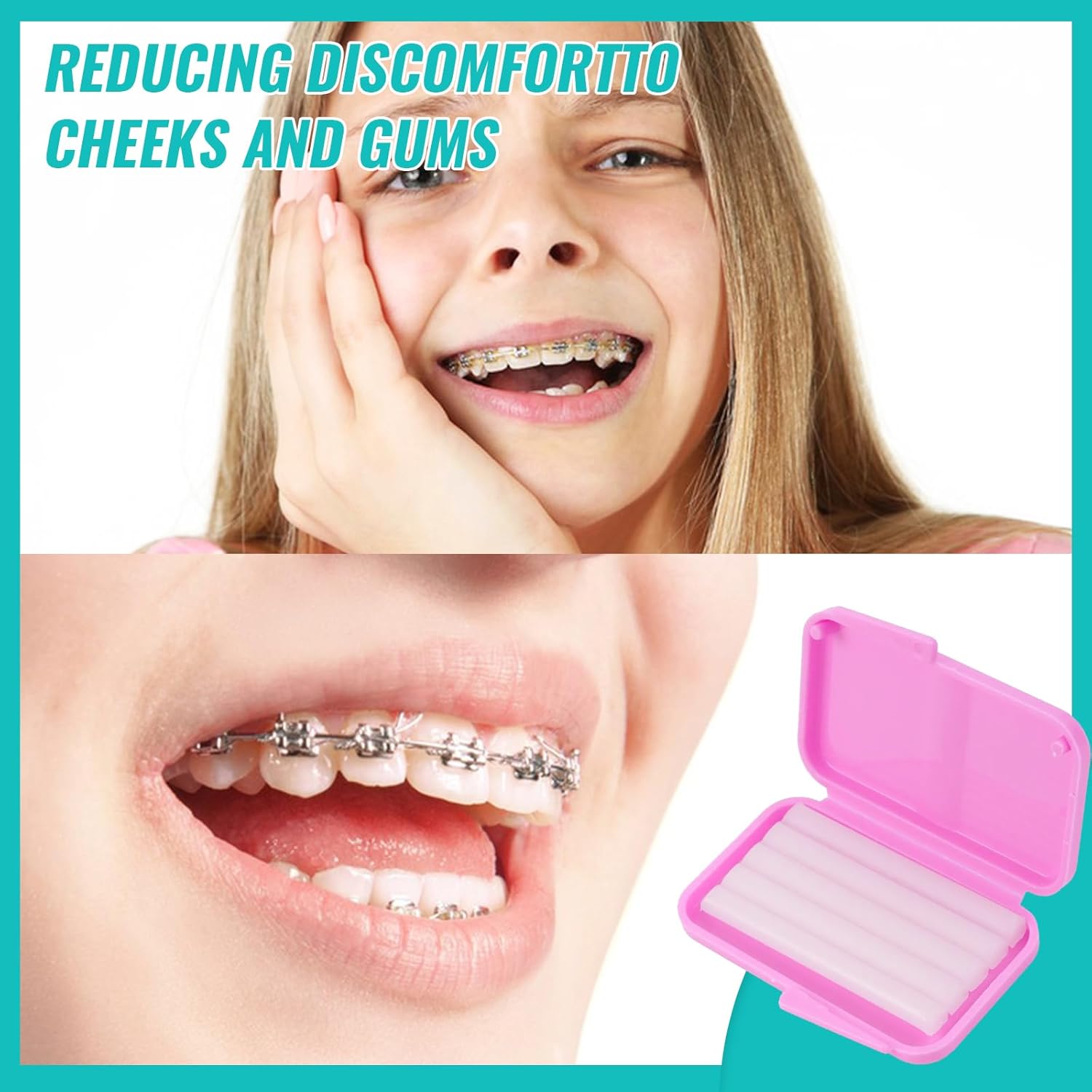 10 коробок стоматологический о – обзор и цена Teeth Whitening Gum