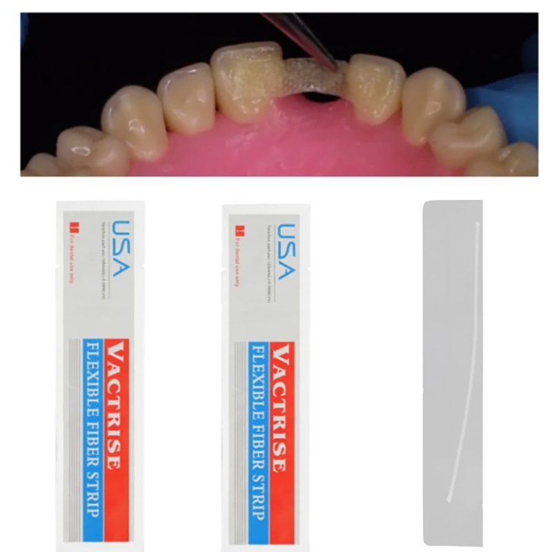 1 шт. Стоматологическая гибкая – обзор и цена Teeth Whitening Zoom