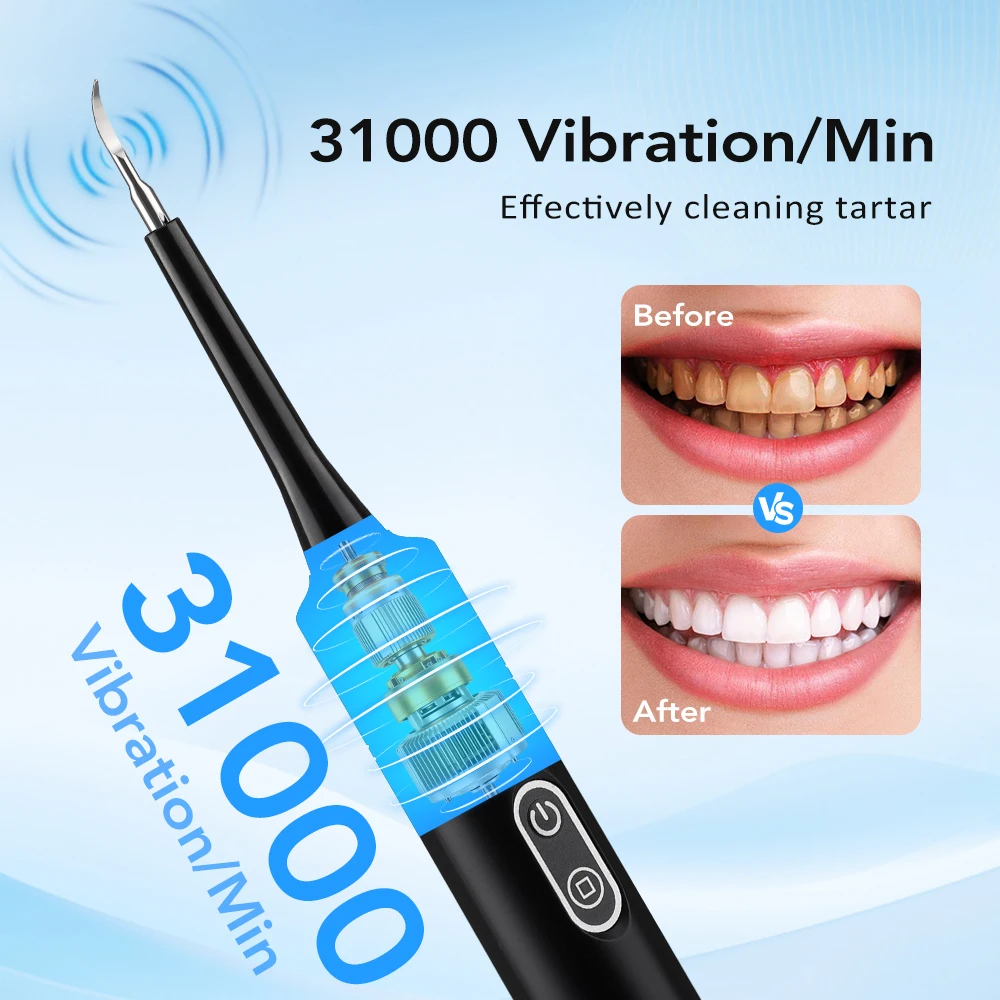 Электрический звуковой вибраци – обзор и цена Electric Toothbrush Sonic